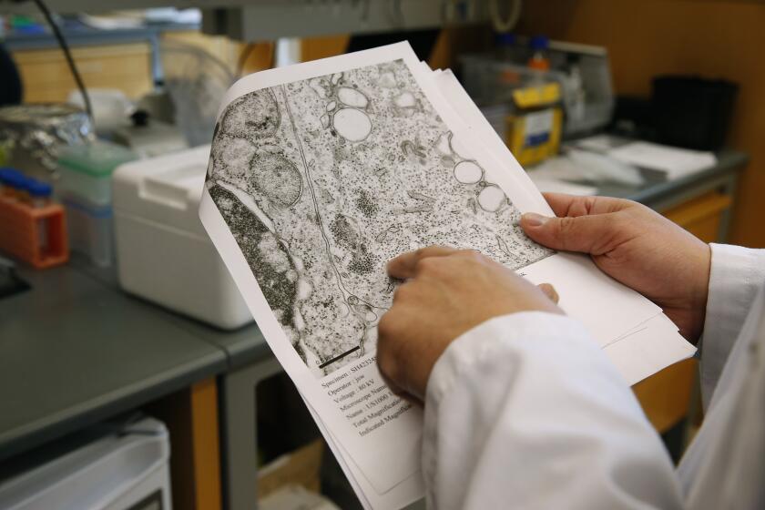 Dr. Charles Chiu reviews microscopic imagery in his lab at the UCSF Mission Bay campus in San Francisco, Calif. on Friday, Feb. 24, 2017. Chiu has published findings on his research about the effects of paralysis in children with the Enterovirus D68 infectious disease. (Photo By Paul Chinn/The San Francisco Chronicle via Getty Images)